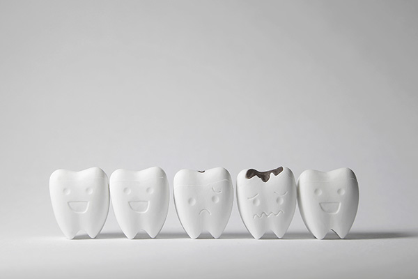 How a General Dentist Can Treat Tooth Decay from Dr. Eric J. Steinbrecher, DDS in Fair Oaks, CA