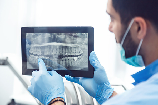 General Dentistry: Are Dental X-rays Recommended? from Dr. Eric J. Steinbrecher, DDS in Fair Oaks, CA
