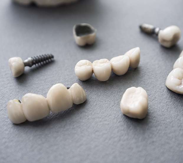 Fair Oaks The Difference Between Dental Implants and Mini Dental Implants
